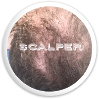Scalper